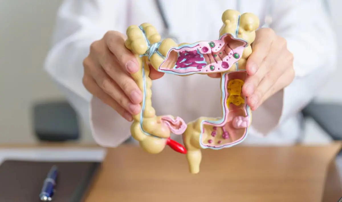 diverticoli